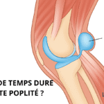 Schéma médical illustrant un kyste poplité derrière le genou, avec la question « Combien de temps dure un kyste poplité ? ». Le kyste est représenté en bleu comme une poche de liquide reliée à la cavité articulaire. Image pédagogique issue de LeTraumato.com.