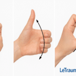 Exercices pour la rhizarthrose du pouce – illustration médicale réalisée par un orthopédiste Traumatologie – LeTraumato.com