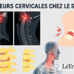 Illustration médicale montrant la colonne cervicale en vue radiologique et schématique, avec zones rouges d’inflammation et signes de compression nerveuse au niveau des vertèbres cervicales, représentant les douleurs cervicales chez le sportif liées au surmenage, à la mauvaise posture ou au traumatisme.