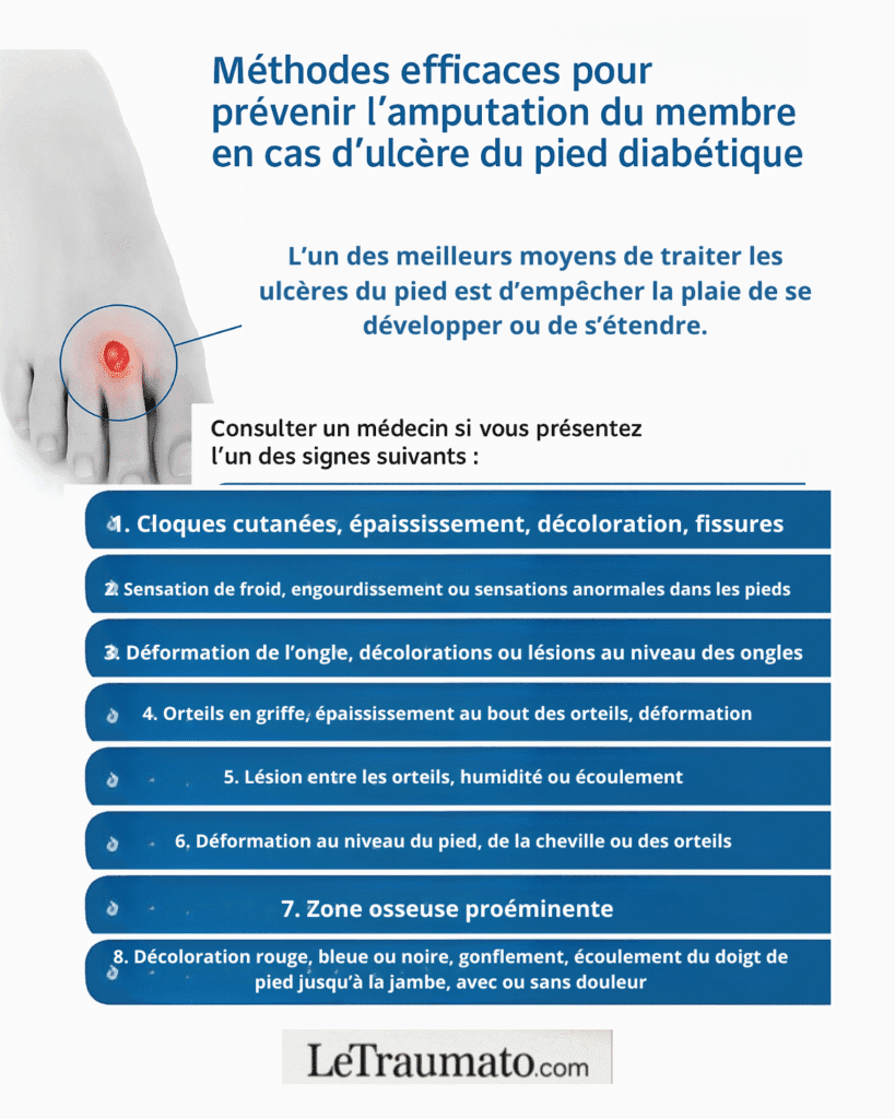 Infographie médicale en français montrant les méthodes efficaces pour prévenir l’amputation du membre en cas d’ulcère du pied diabétique, avec une illustration d’un orteil ulcéré et une liste de signes d’alerte nécessitant une consultation médicale rapide. Visuel éducatif LeTraumato.com.