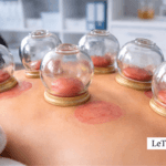 Séance de hijama en cabinet médical moderne avec ventouses thérapeutiques sur le dos, approche de médecine complémentaire, LeTraumato.com