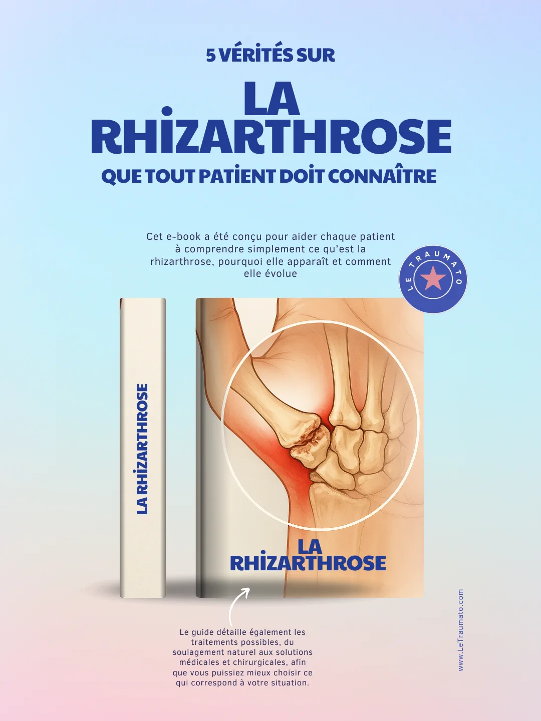 Rhizarthrose