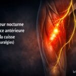 Illustration médicale montrant une douleur nocturne de la face antérieure de la cuisse avec zones lumineuses musculaires et trajet du nerf crural, évocatrice d’une cruralgie