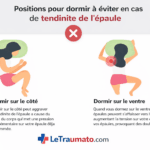 Illustration médicale montrant les positions de sommeil à éviter en cas de tendinite de l’épaule, notamment dormir sur le côté douloureux et sur le ventre, avec mise en évidence de la zone inflammatoire de l’épaule. Image pédagogique LeTraumato.com.