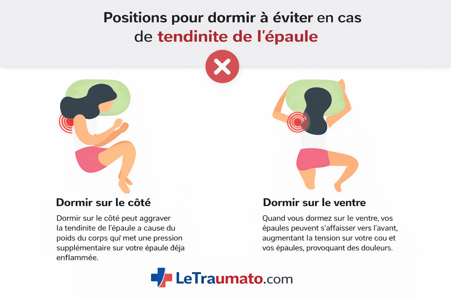 Illustration médicale montrant les positions de sommeil à éviter en cas de tendinite de l’épaule, notamment dormir sur le côté douloureux et sur le ventre, avec mise en évidence de la zone inflammatoire de l’épaule. Image pédagogique LeTraumato.com.