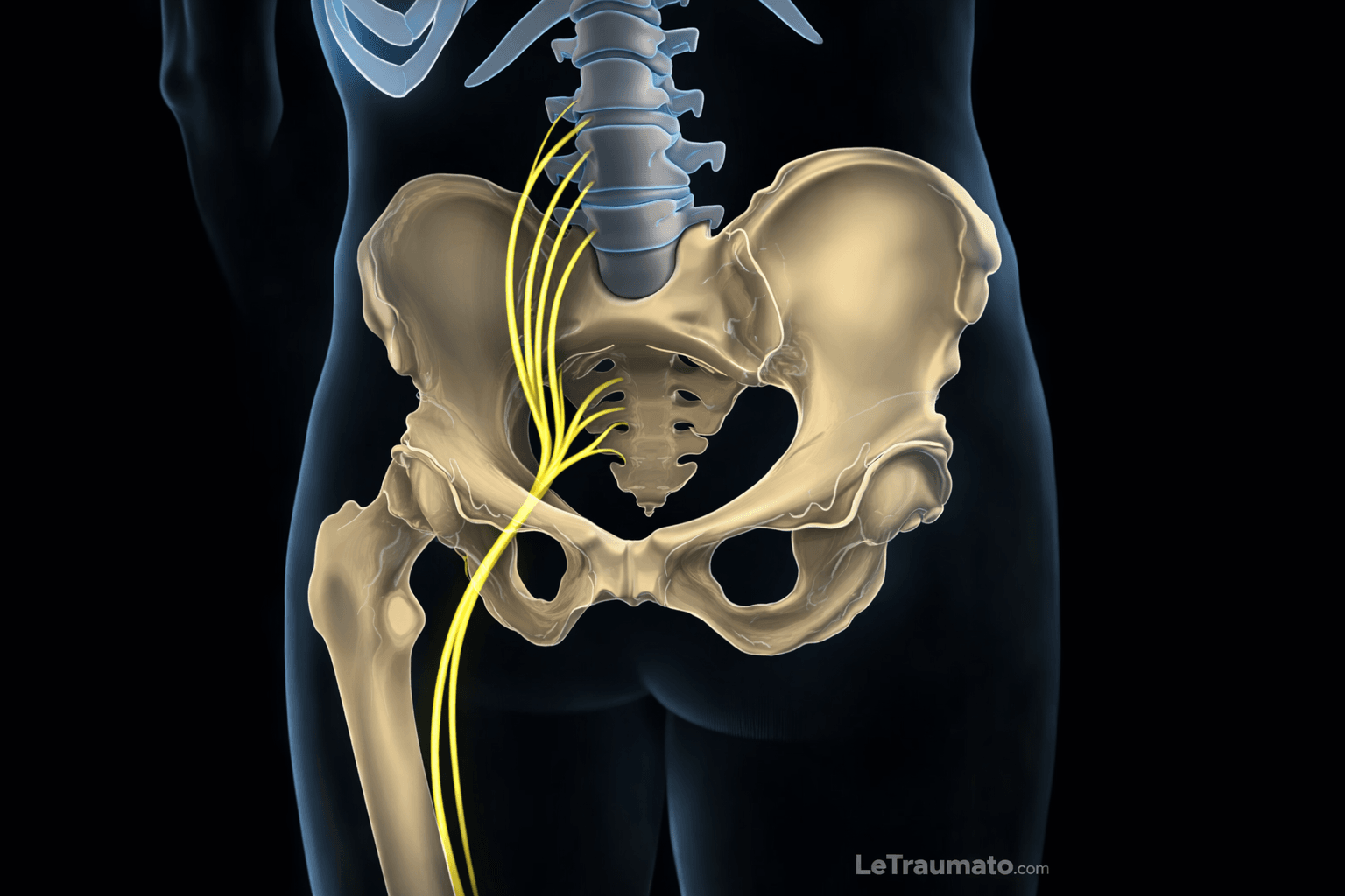 Illustration médicale détaillée montrant le trajet anatomique du nerf sciatique depuis les racines lombaires et sacrées à travers le bassin et la hanche, avec visualisation précise du sacrum, du bassin et du fémur. Le nerf sciatique est mis en évidence en jaune sur fond sombre afin d’illustrer les mécanismes de la douleur sciatique et ses zones de compression possibles. Image pédagogique destinée à l’information médicale sur la sciatique.