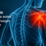 Illustration médicale d’une douleur à l’épaule persistante malgré les soins avec question sur un dossier MDPH