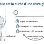 Image explicatif de: Quelle est la durée d'une cruralgie ? et Quelle est la durée dune névralgie crurale ?